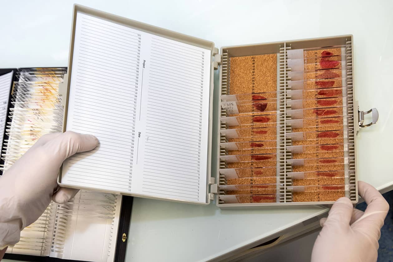 <hr>Boite de lames histologiques colorées à l’hématoxyline-éosine et réalisées pour un projet de recherche.