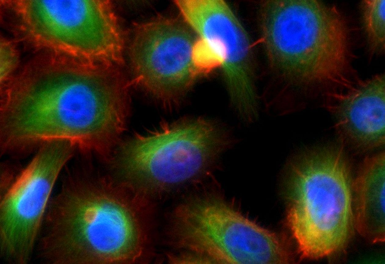 <hr>Immunofluorescence du cytosquelette de cellules PC3. Tubuline en vert, actine en rouge et noyaux en bleu.