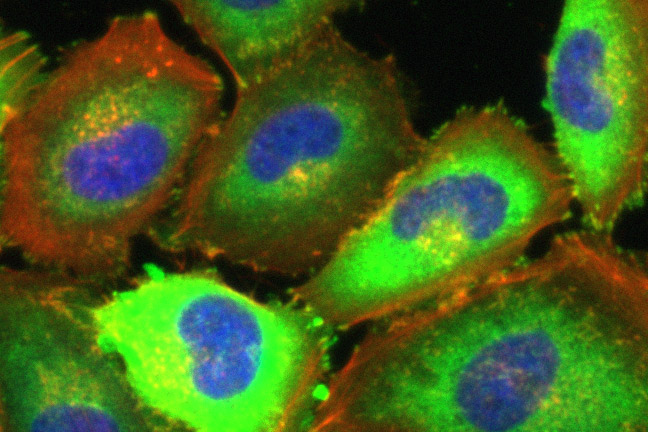 <hr>Immunofluorescence de protéines d’adhésion (vinculine) dans des cellules PC3. Vinculine en vert et fibres d’actine en rouge.