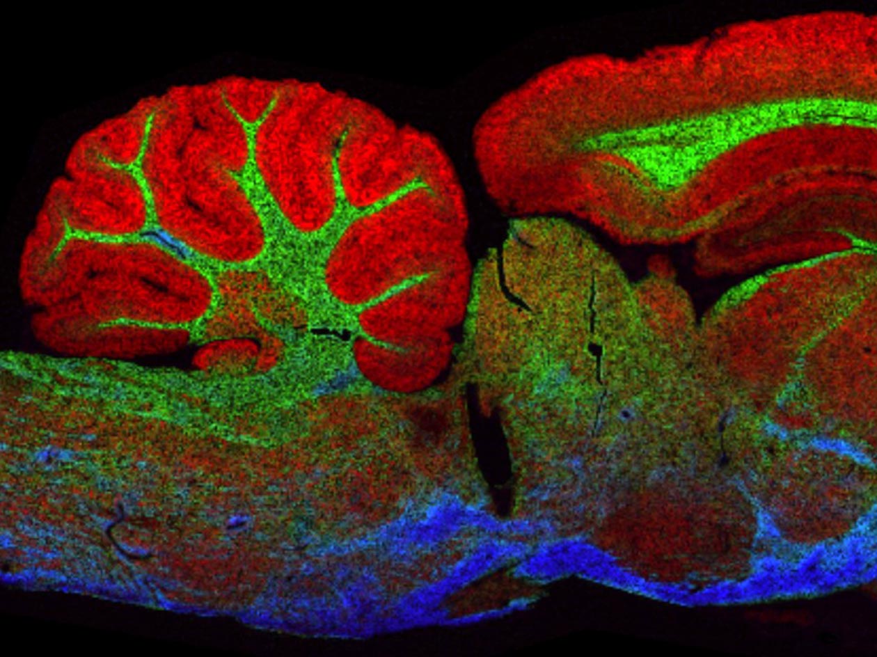 <hr>Distribution de trois molécules sur une coupe de cerveau de rat observée en imagerie MALDI (résolution spatiale de 20 µm).