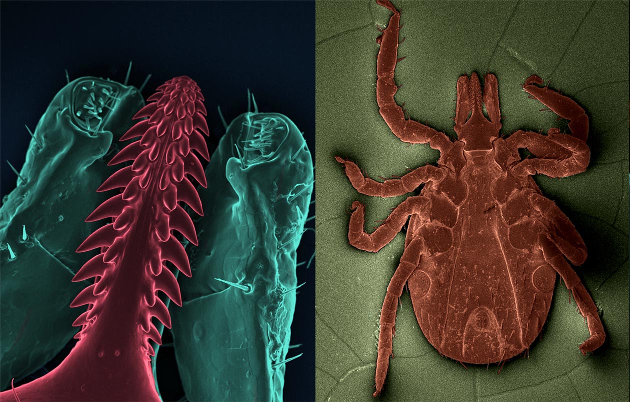 <hr>Différents organes de tique observés en SEM.