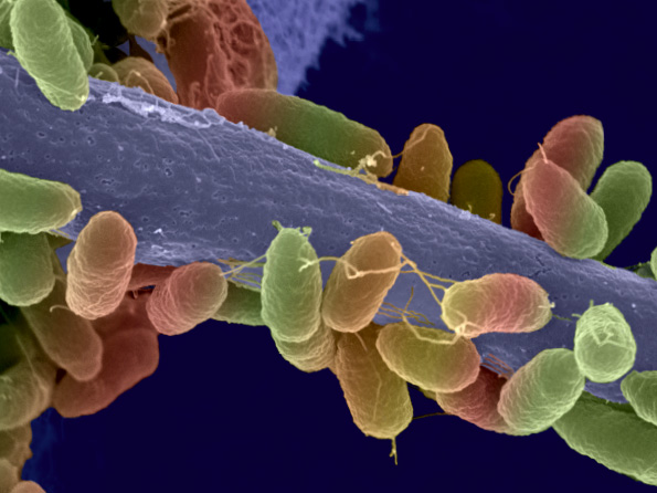 <hr>Bactéries observées en microscopie électronique à balayage.