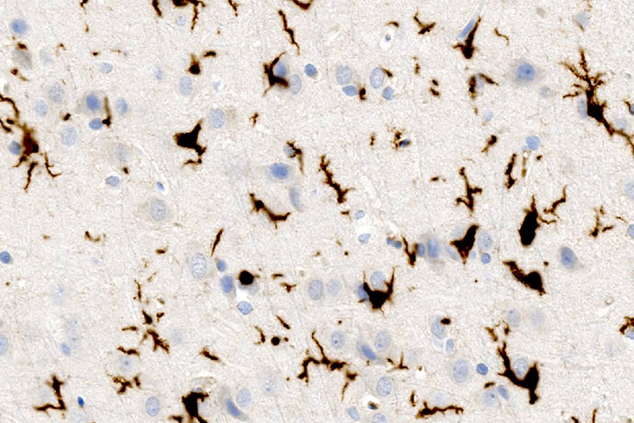 <hr>Cellules de Kupffer du foie colorées par IHC chromogénique.
