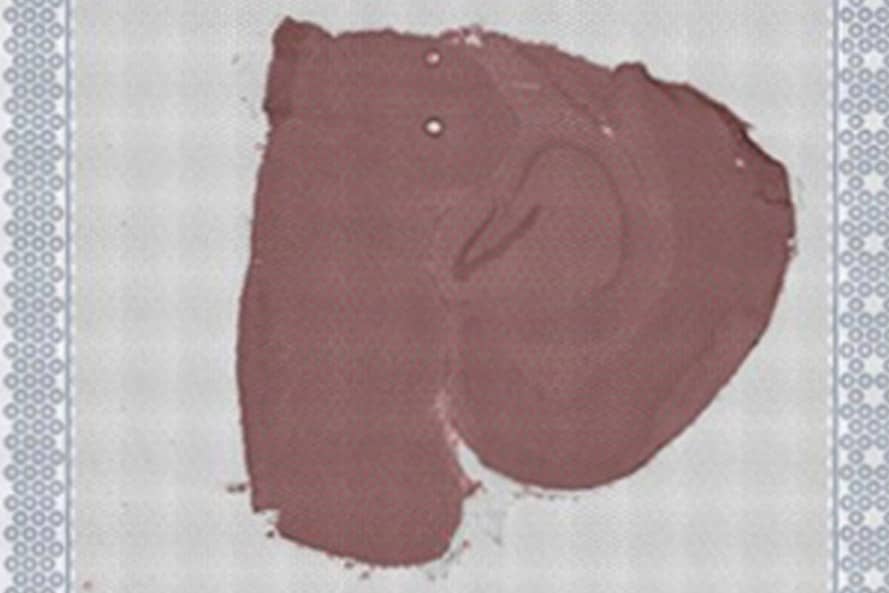 <hr>Coupe de cerveau colorée par H&E sur lame Visium.