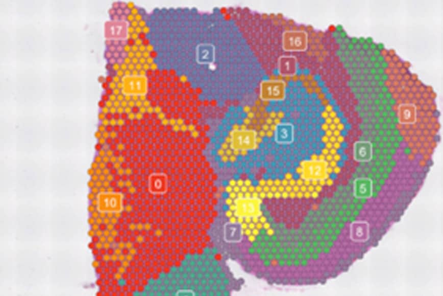 <hr>Coupe de cerveau avec transcriptome Visum.